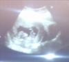 My Daughter Due 30/06/2012